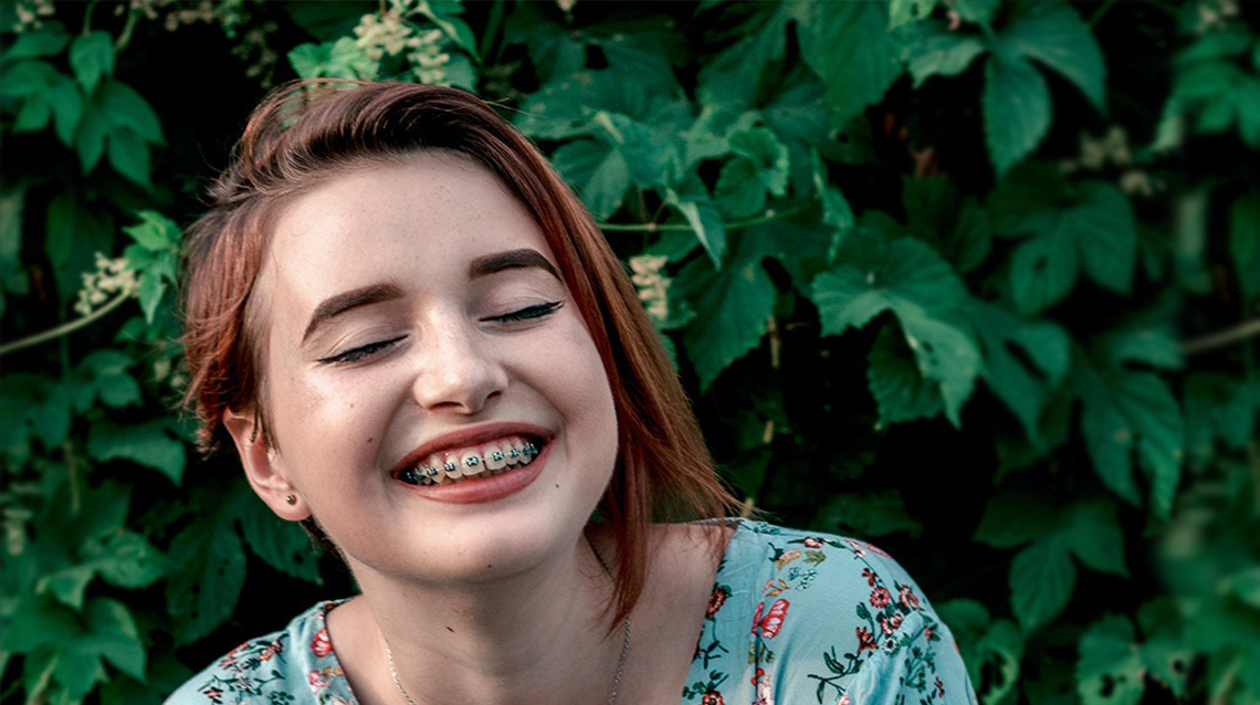 Discover fixed braces